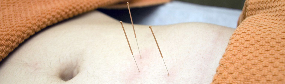 Accupuncture, Eastern Healing Arts in the Perkasie, Bucks County PA area